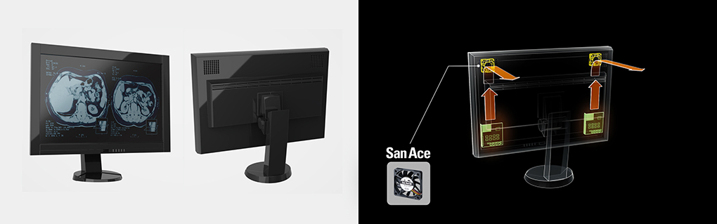 How Do High-Resolution Medical Displays Manage Heat-01